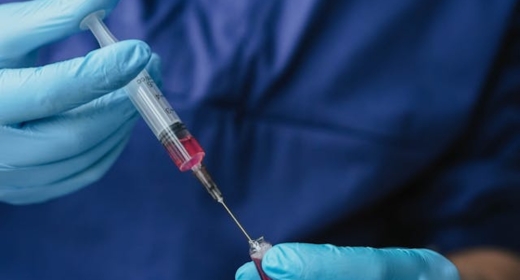 best Orthopaedic platelet rich plasma therapy in Hyderabad